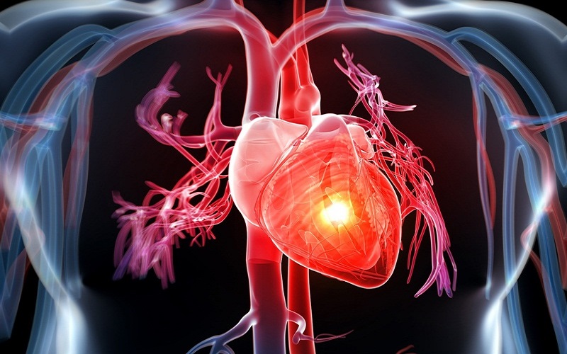 Một người đàn ông 53 tuổi chết vì đau tim đột ngột, bác sĩ nhắc nhở: Mọi người nên tránh xa 5 điều này