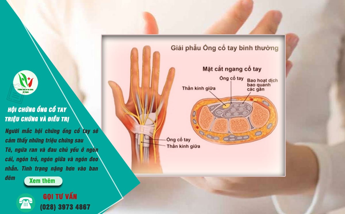 Chẩn đoán và điều trị hội chứng ống cổ tay