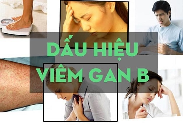 Triệu chứng bệnh Viêm Gan B mà bạn không nên bỏ qua