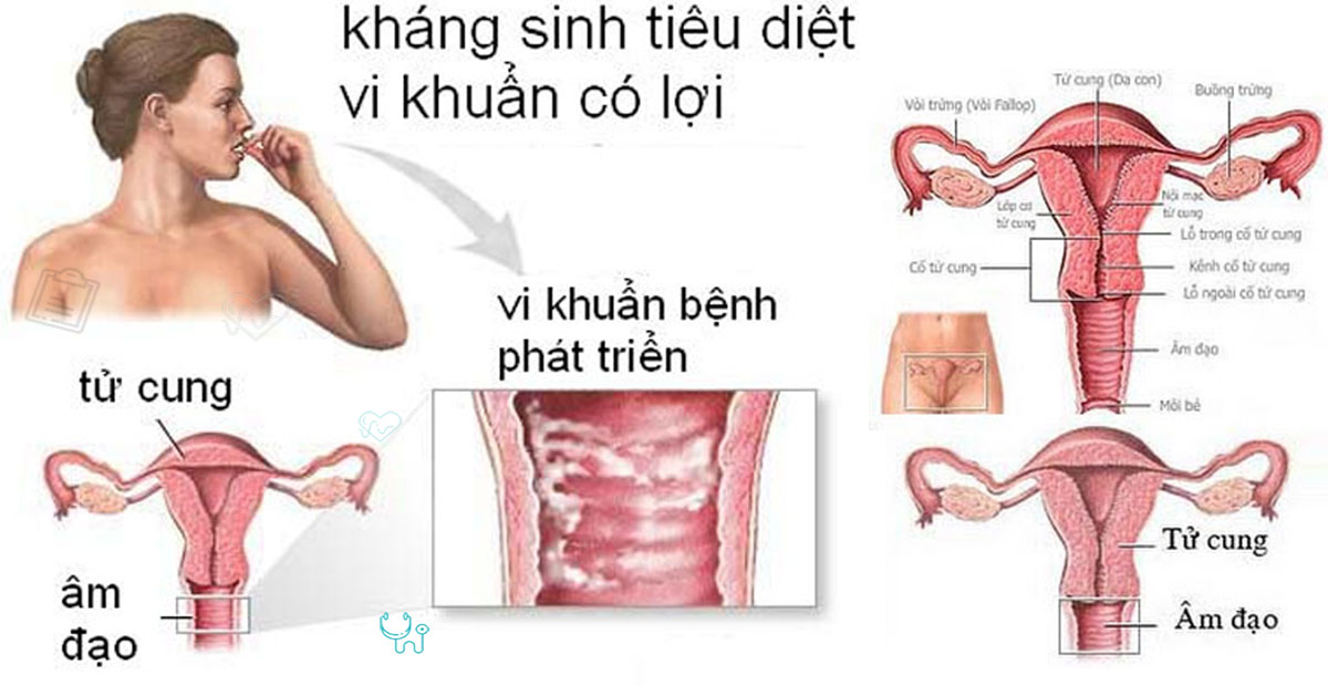 Nhiễm khuẩn đường sinh dục nguyên nhân và cách khắc phục