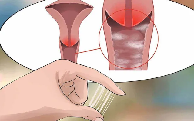 BỆNH VIÊM ÂM ĐẠO LÀ GÌ? DẤU HIỆU NHẬN BIẾT VÀ CÁCH ĐIỀU TRỊ ĐÚNG