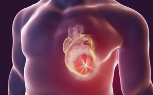 Cảnh báo triệu chứng thường gặp của đau tim nhưng ít người chú ý