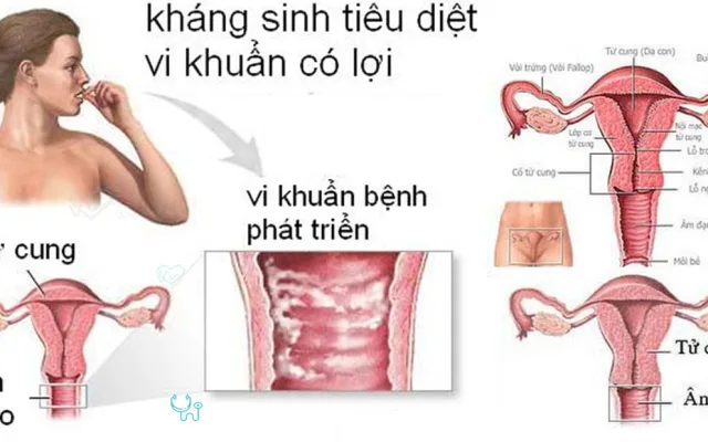 Nhiễm khuẩn đường sinh dục nguyên nhân và cách khắc phục