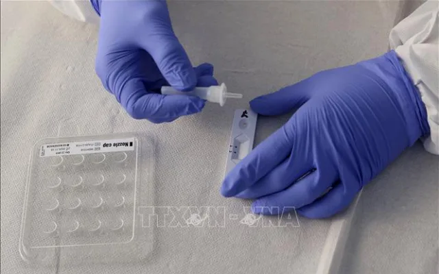 Phát hiện mới giúp chẩn đoán bệnh COVID-19 qua xét nghiệm máu﻿