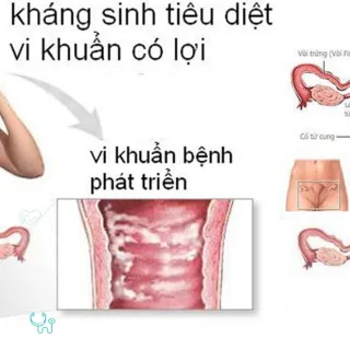 Nhiễm khuẩn đường sinh dục nguyên nhân và cách khắc phục