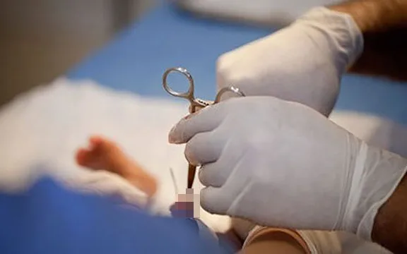 Vì sao cần cắt bao quy đầu? Khi nào nên thực hiện cắt bao quy đầu?