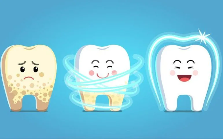 BÁO ĐỘNG ĐỎ VỀ TÌNH TRẠNG RĂNG MIỆNG TẠI VIỆT NAM