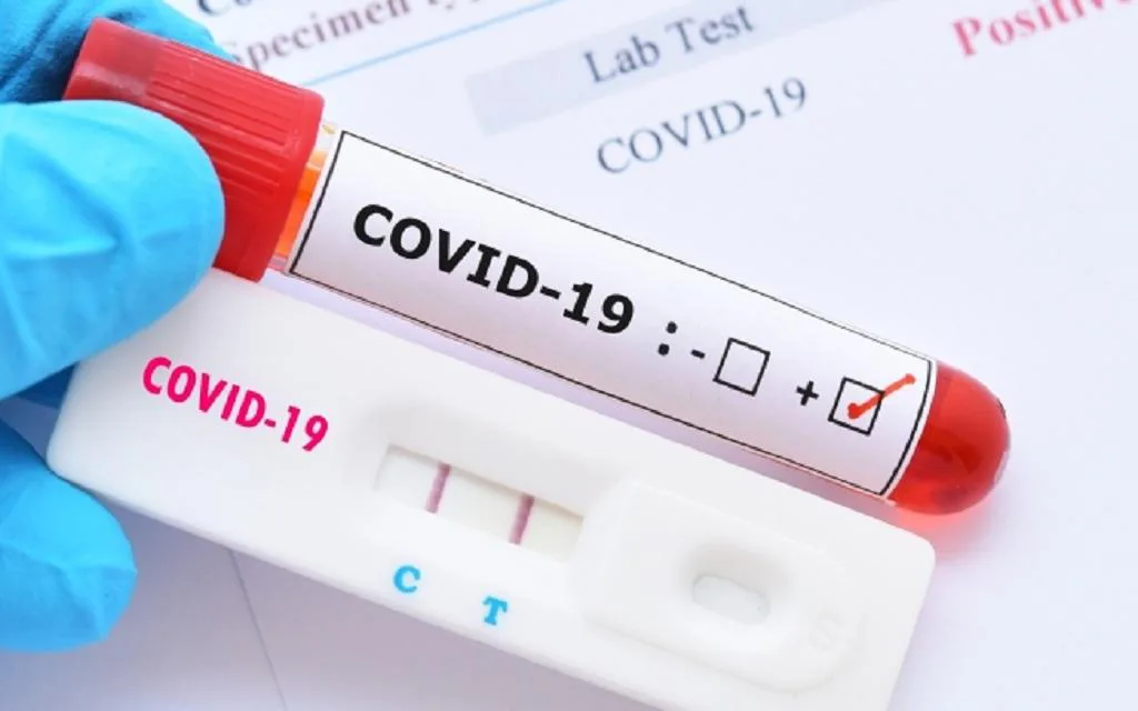 Sau khi tiếp xúc F0, cần bao lâu thì test mới có kết quả chính xác?