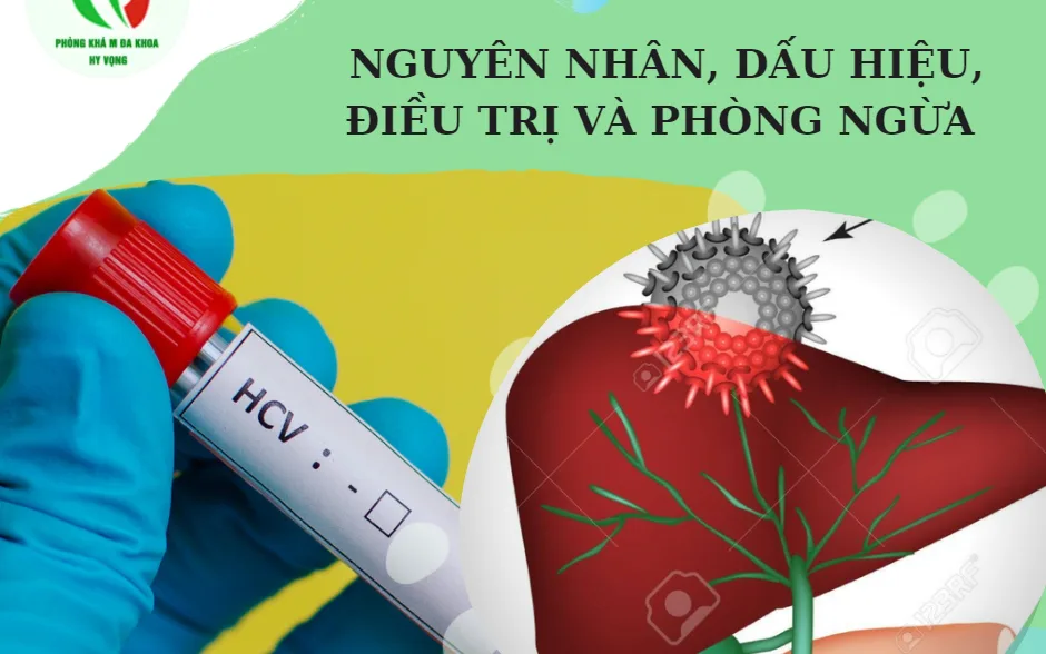 VIÊM GAN C: NGUYÊN NHÂN, DẤU HIỆU, ĐIỀU TRỊ VÀ PHÒNG NGỪA