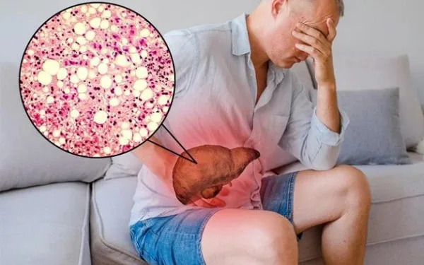 Gan nhiễm mỡ nên ăn gì để cải thiện bệnh