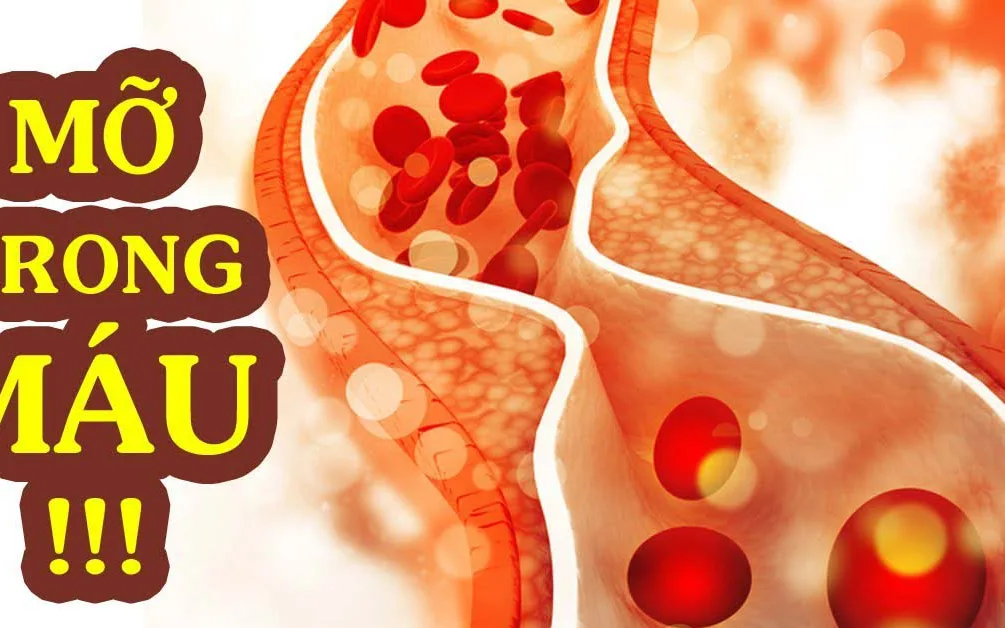 Nguyên nhân nào khiến người gầy vẫn có nguy cơ bị mỡ máu cao?