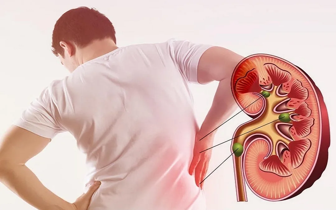 5 dấu hiệu trên da cảnh báo bệnh thận