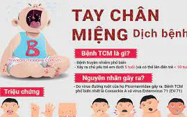 Bệnh tay chân miệng: Nguyên nhân, triệu chứng và các biện pháp phòng ngừa
