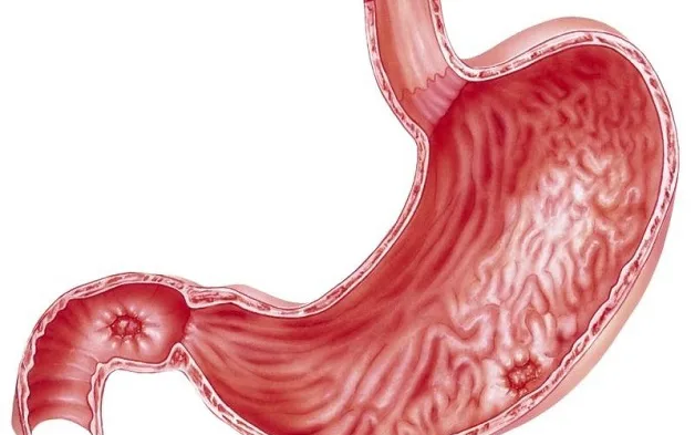 Đau bụng trên có phải đau dạ dày? Khi nào cần gặp bác sĩ?